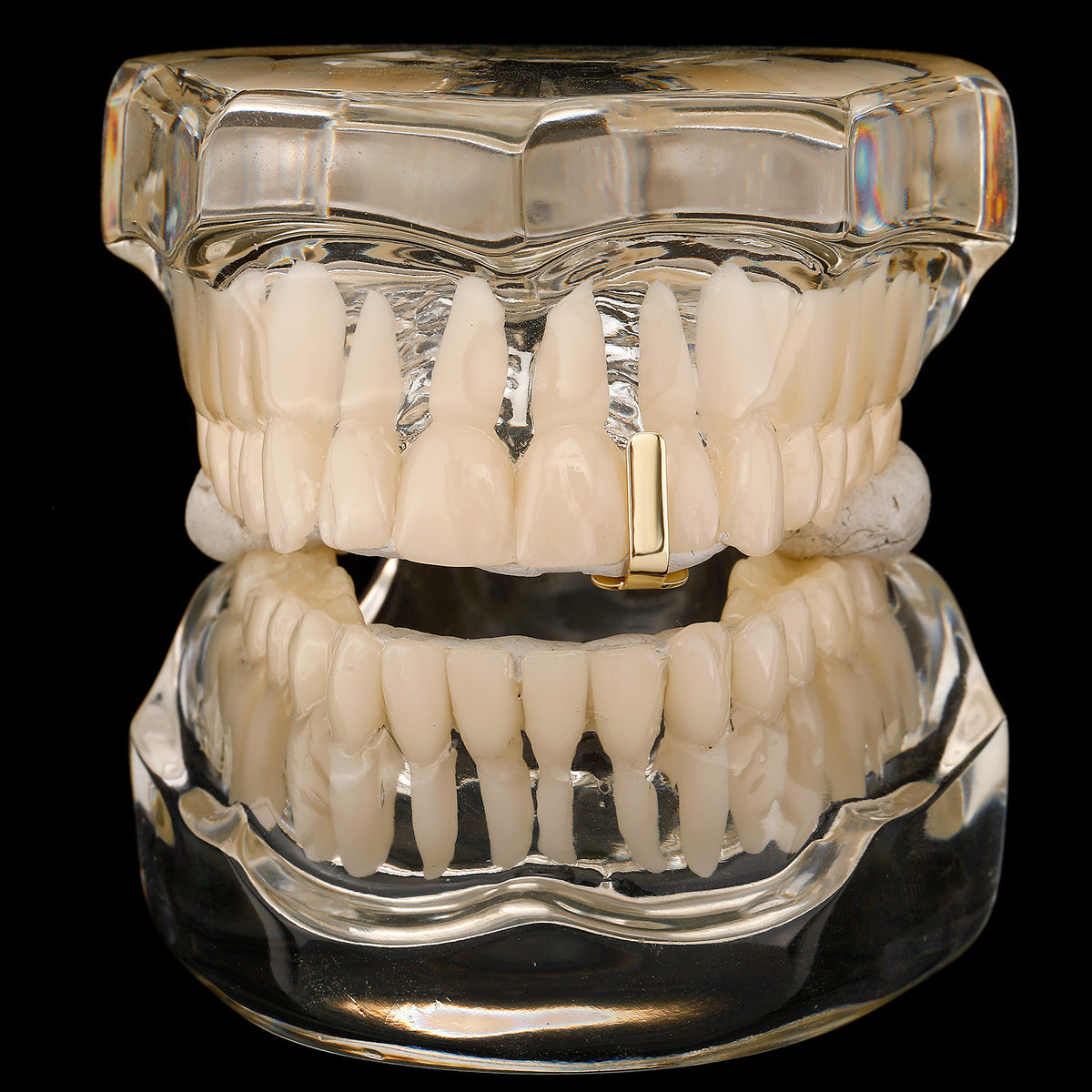 Gold smooth bar tooth cap shown on the front of a clear dental display