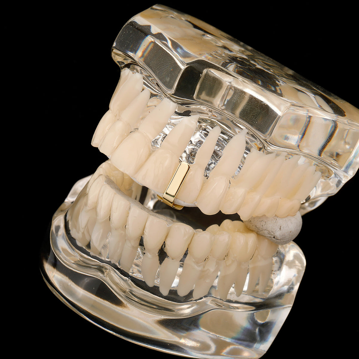 Gold smooth bar tooth cap shown on a clear dental display at an angle