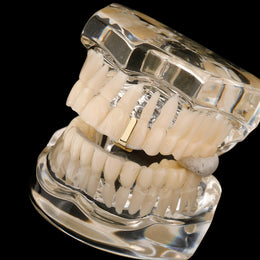 Gold smooth bar tooth cap shown on a clear dental display at an angle